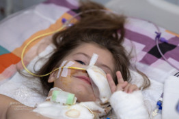 Діти, які на лікарняних ліжках опинилися через російську агресію4