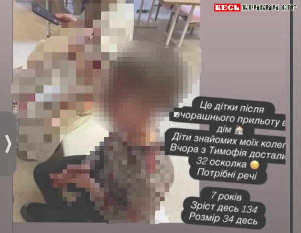 7-річний Тимофій постраждав від повітряного удару по Кривому Рогу