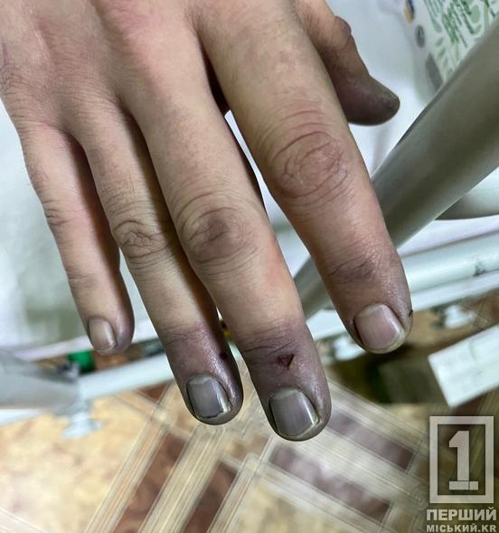 Від морозу посиніли пальці: чоловіки з Дніпра та Полтавщини ледь не загинули при «мандрівці» до кордону4