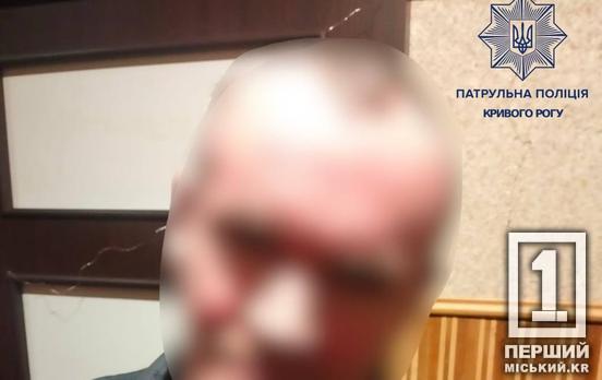 Градус у крові викликав гостре бажання поспілкуватися з кимось у формі: криворіжець сам на себе заявив до поліції