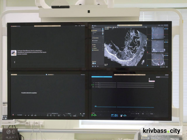 Майже 8 тисяч врятованих життів: як у Кривому Розі працює програма «Стоп-інфаркт»4