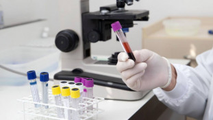 На Дніпропетровщині знову фіксується зростання захворюваності на ГРВІ0