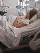 На Дніпропетровщині власниці собаки, через напад якого дитина втратила ногу, повідомили про підозру