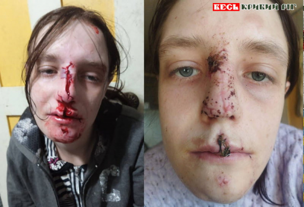 Обличчя Даші розірвав вівчар в Кривому Розі