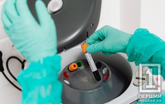 Кір у Дніпрі та сезонні віруси: як змінилася епідемічна ситуація в області за тиждень