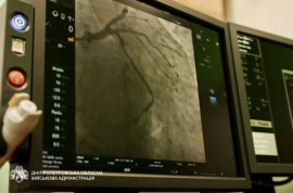 На Дніпропетровщині провели 179 безкоштовних стентувань від початку року