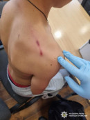 На Закарпатті дев’ятикласник вистрілив у школі з травматичного пістолета