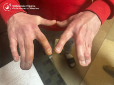 Незаконне утримання та антисанітарія: результати перевірки ТЦК на Закарпатті