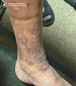 Незаконне утримання та антисанітарія: результати перевірки ТЦК на Закарпатті