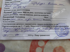 У Кривому Розі бродячий пес напав на 9-річну дівчинку