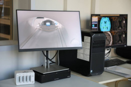 У Кривому Розі запрацював унікальний для України апарат МРТ: діагностика доступна навіть для немовлят