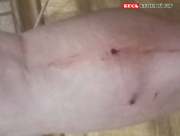 Жінку покусала зграя собак на ПівнГЗК в Кривому Розі