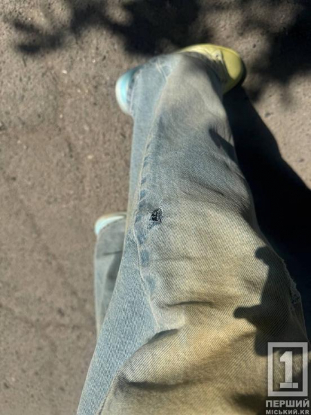 На Даманському вулична собака напала на дівчину: деталі події