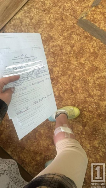На Даманському вулична собака напала на дівчину: деталі події