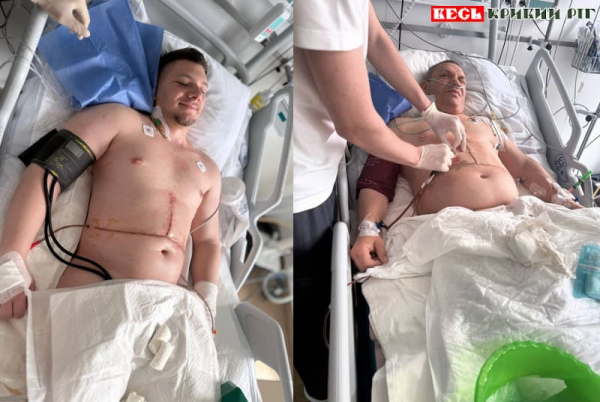 Життя Володимира Корецького з Кривого Рогу врятував син
