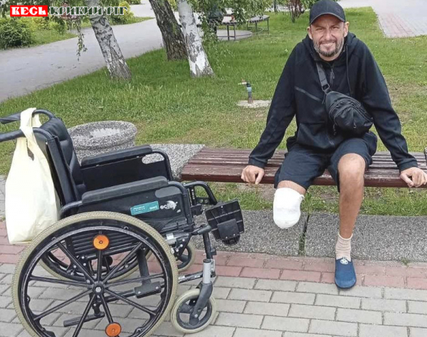 Лишився ноги в бою Максим &laquo;Циган&raquo; з криворізького полку АРЕЙ