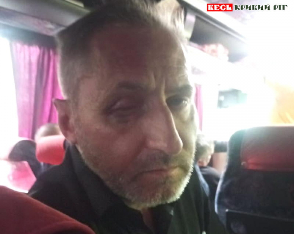 Ветеран стверджує, що його побили в Саксаганському ТЦК в Кривому Розі