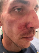 У Польщі напали на трьох українців через музику з автомобіля
