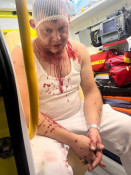 У Польщі напали на трьох українців через музику з автомобіля