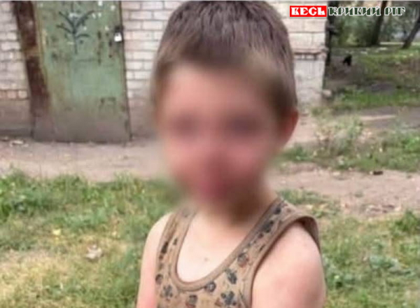 8-річний хлопчик втік від батька-алкаша в Кривому Розі