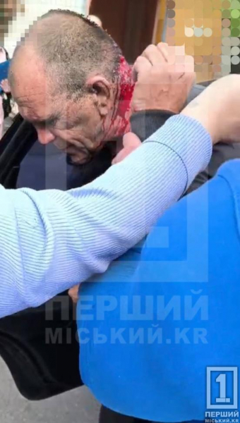 Російські війська вдарили двома «Бандеролями» по території лікарні у Кривому Розі: троє поранених