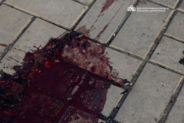 Сьогодні противник майже 40 разів цілив по 4 районах Дніпропетровщини: 18 людей дістали поранень. Серед постраждалих – діти